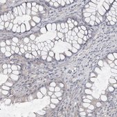 Anti-CA6 antibody produced in rabbit Prestige Antibodies® Powered by Atlas Antibodies, affinity isolated antibody, buffered aqueous glycerol solution, ab2