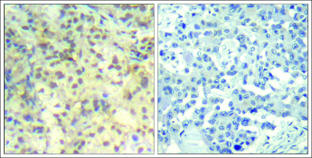 Anti-phospho-CFL1 (pTyr139) antibody produced in rabbit affinity isolated antibody