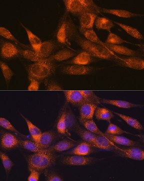 Anti-RheB Antibody, clone 5S8F1, Rabbit Monoclonal