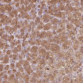Anti-DHCR24 antibody produced in rabbit Prestige Antibodies&#174; Powered by Atlas Antibodies, affinity isolated antibody, buffered aqueous glycerol solution