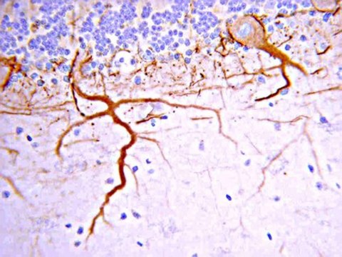 Anti-Neurofilament M (145 kDa) Antibody, CT serum, Chemicon&#174;
