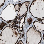 Anti-TPO antibody produced in rabbit Prestige Antibodies&#174; Powered by Atlas Antibodies, affinity isolated antibody, buffered aqueous glycerol solution