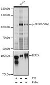 Anti-Phospho-EEF2K-S366 antibody produced in rabbit