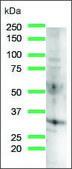 Anti-Cyclin D3 antibody, Rabbit monoclonal recombinant, expressed in proprietary host, clone SP207, affinity isolated antibody