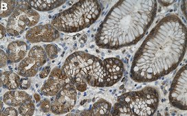 Anti-IDE Antibody, clone 1J8 ZooMAb&#174; Rabbit Monoclonal recombinant, expressed in HEK 293 cells