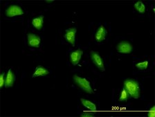 Monoclonal Anti-G3BP antibody produced in mouse clone 2F3, purified immunoglobulin, buffered aqueous solution
