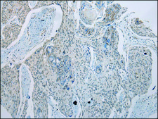 Anti-GDF10 affinity isolated antibody
