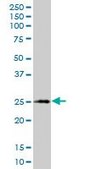 Monoclonal Anti-XBP1 antibody produced in mouse clone 2D9, purified immunoglobulin, buffered aqueous solution