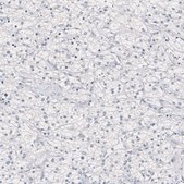 Monoclonal Anti-NANOG antibody produced in mouse Prestige Antibodies&#174; Powered by Atlas Antibodies, clone CL5810, purified immunoglobulin, buffered aqueous glycerol solution