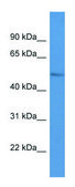Anti-LPL (C-terminal) antibody produced in rabbit affinity isolated antibody