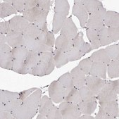 Anti-FAS antibody produced in rabbit Prestige Antibodies® Powered by Atlas Antibodies, affinity isolated antibody, buffered aqueous glycerol solution