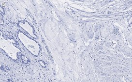 Anti-Vinculin Antibody, clone 3M13 ZooMAb® Rabbit Monoclonal recombinant, expressed in HEK 293 cells