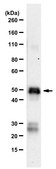 Anti-SARS-CoV-1/2 NP Antibody, clone 1C7C7 ZooMAb&#174; Mouse Monoclonal recombinant, expressed in HEK 293 cells