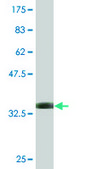 Monoclonal Anti-ALDOA antibody produced in mouse clone 2E6, purified immunoglobulin, buffered aqueous solution