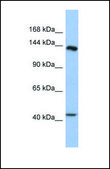 Anti-SLIT1 antibody produced in rabbit affinity isolated antibody