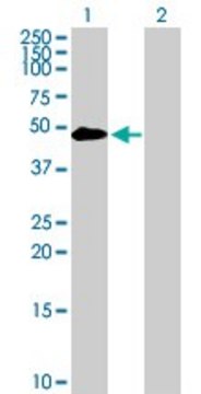 Anti-TYR antibody produced in mouse purified immunoglobulin, buffered aqueous solution