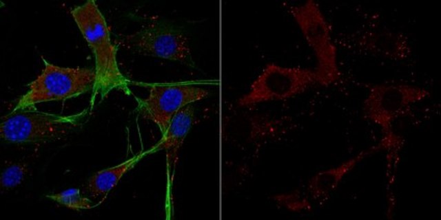 Anti-Cofilin-1 Antibody from rabbit, purified by affinity chromatography
