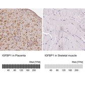 Anti-IGFBP1 antibody produced in rabbit Prestige Antibodies® Powered by Atlas Antibodies, affinity isolated antibody, buffered aqueous glycerol solution