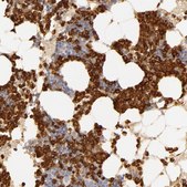 Anti-C1R antibody produced in rabbit Prestige Antibodies&#174; Powered by Atlas Antibodies, affinity isolated antibody, buffered aqueous glycerol solution