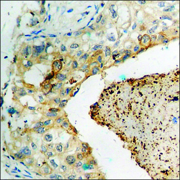 Anti-phospho-GluR1 (pSer849) antibody produced in rabbit affinity isolated antibody