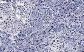 Anti-hnRNP A1 Antibody, clone 9H10 ZooMAb&#174; Mouse Monoclonal recombinant, expressed in HEK 293 cells