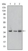 Anti-LIMS1, clone 5G7 Antibody ascites fluid, clone 5G7, from mouse