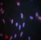 Anti-Dlx2 Antibody Chemicon&#174;, from rabbit