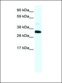 Anti-ANXA3 (AB1) antibody produced in rabbit IgG fraction of antiserum