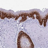 Anti-KRT5 antibody produced in rabbit Prestige Antibodies&#174; Powered by Atlas Antibodies, affinity isolated antibody, buffered aqueous glycerol solution