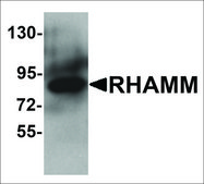 Anti-HMMR antibody produced in rabbit affinity isolated antibody