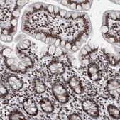 Anti-TOP2B antibody produced in rabbit Prestige Antibodies&#174; Powered by Atlas Antibodies, affinity isolated antibody, buffered aqueous glycerol solution