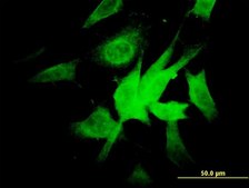 Monoclonal Anti-NDUFA9 antibody produced in mouse clone 3D7, purified immunoglobulin, buffered aqueous solution