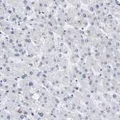 Anti-PCNT antibody produced in rabbit Prestige Antibodies&#174; Powered by Atlas Antibodies, affinity isolated antibody, buffered aqueous glycerol solution, Ab1