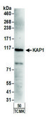 Rabbit anti-KAP-1 Antibody, Affinity Purified Powered by Bethyl Laboratories, Inc.