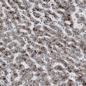 Anti-ACAA1 antibody produced in rabbit Ab1, Prestige Antibodies&#174; Powered by Atlas Antibodies, affinity isolated antibody, buffered aqueous glycerol solution