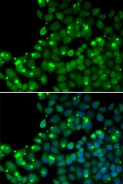 Anti-MGMT antibody produced in rabbit
