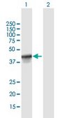 Anti-FANCL antibody produced in mouse IgG fraction of antiserum, buffered aqueous solution