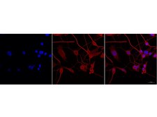 Milli-Mark&#174; Pan Neuronal Marker Milli-Mark Pan Neuronal Marker is an antibody targeting the Pan Neuronal Marker protein, validated for use in ICC, IHC, IF &amp; IHC.