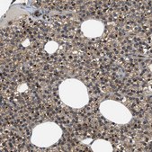 Anti-EIF2AK3 antibody produced in rabbit Prestige Antibodies&#174; Powered by Atlas Antibodies, affinity isolated antibody, buffered aqueous glycerol solution