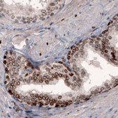 Monoclonal Anti-LMNB1 antibody produced in mouse Prestige Antibodies® Powered by Atlas Antibodies, clone CL3929, purified immunoglobulin, buffered aqueous glycerol solution