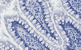 Anti-IRF-1 Antibody, clone 2L6 ZooMAb&#174; Rabbit Monoclonal recombinant, expressed in HEK 293 cells