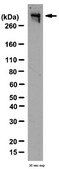 Anti-InsP3R Antibody, Type 1 from rabbit, purified by affinity chromatography
