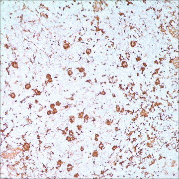 Fascin (55k-2) Mouse Monoclonal Antibody