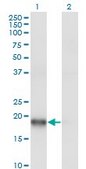 Monoclonal Anti-ARPC3, (N-terminal) antibody produced in mouse clone 2E11, purified immunoglobulin, buffered aqueous solution
