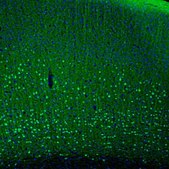 Anti-PCP4 antibody produced in rabbit Prestige Antibodies&#174; Powered by Atlas Antibodies, affinity isolated antibody, buffered aqueous glycerol solution