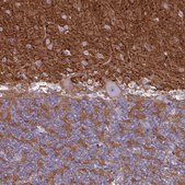 Anti-NCAM1 antibody produced in rabbit Prestige Antibodies&#174; Powered by Atlas Antibodies, affinity isolated antibody, buffered aqueous glycerol solution
