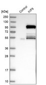 Anti-KIF9 antibody produced in rabbit Prestige Antibodies&#174; Powered by Atlas Antibodies, affinity isolated antibody, buffered aqueous glycerol solution, Ab2