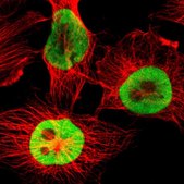 ANTI-HNRNPD antibody produced in rabbit Prestige Antibodies&#174; Powered by Atlas Antibodies, affinity isolated antibody, buffered aqueous glycerol solution