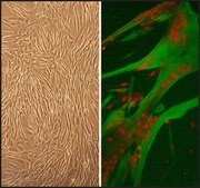 Human Skeletal Muscle Cells: HSkMC, fetal