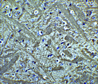 Anti-Bcl-2 (ab1) antibody produced in rabbit affinity isolated antibody, buffered aqueous solution